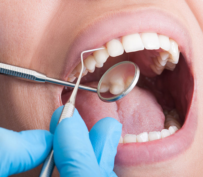 dental cleanings in kitchener