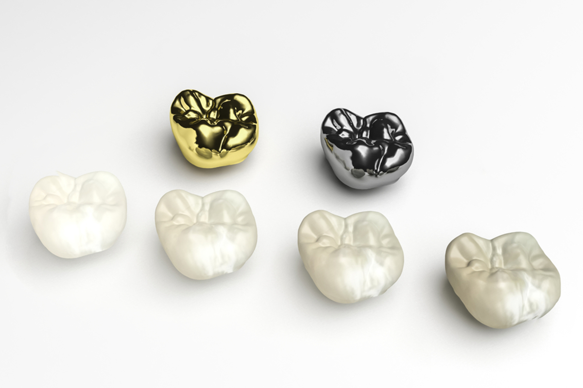 an introduction to dental crowns