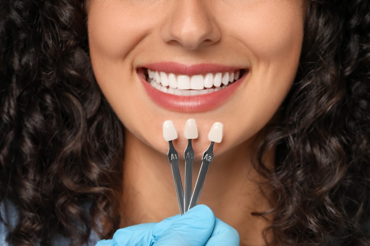 types of dental crowns pros and cons explained