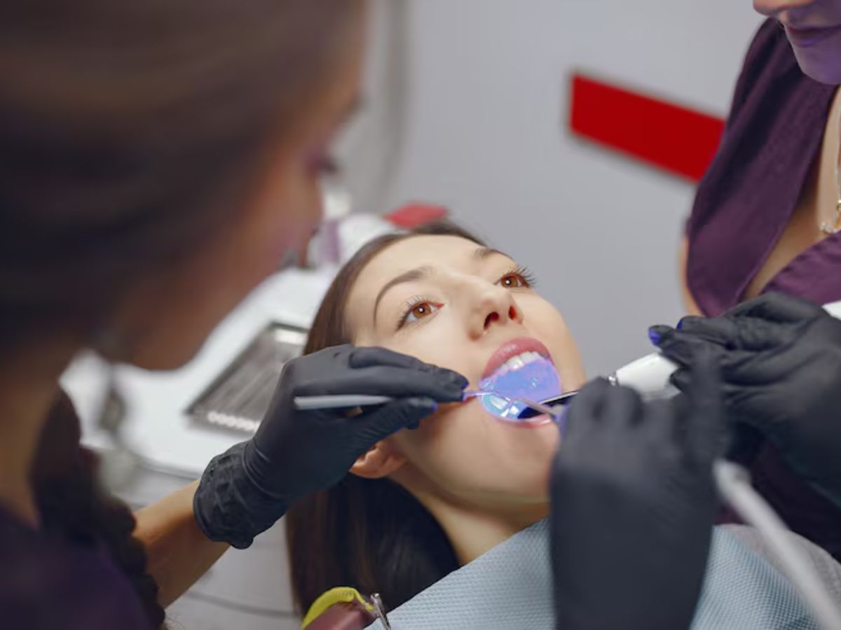 dental bonding being applied to repair a chipped tooth and restore its natural shape and appearance